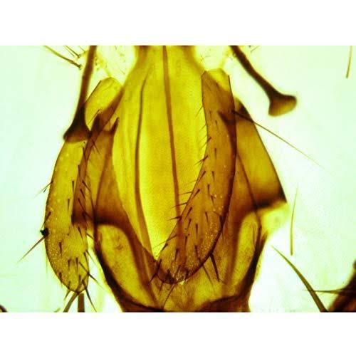 40X-2000X Binocular Lab Compound Microscope with Double Layer Mechanical Stage U249